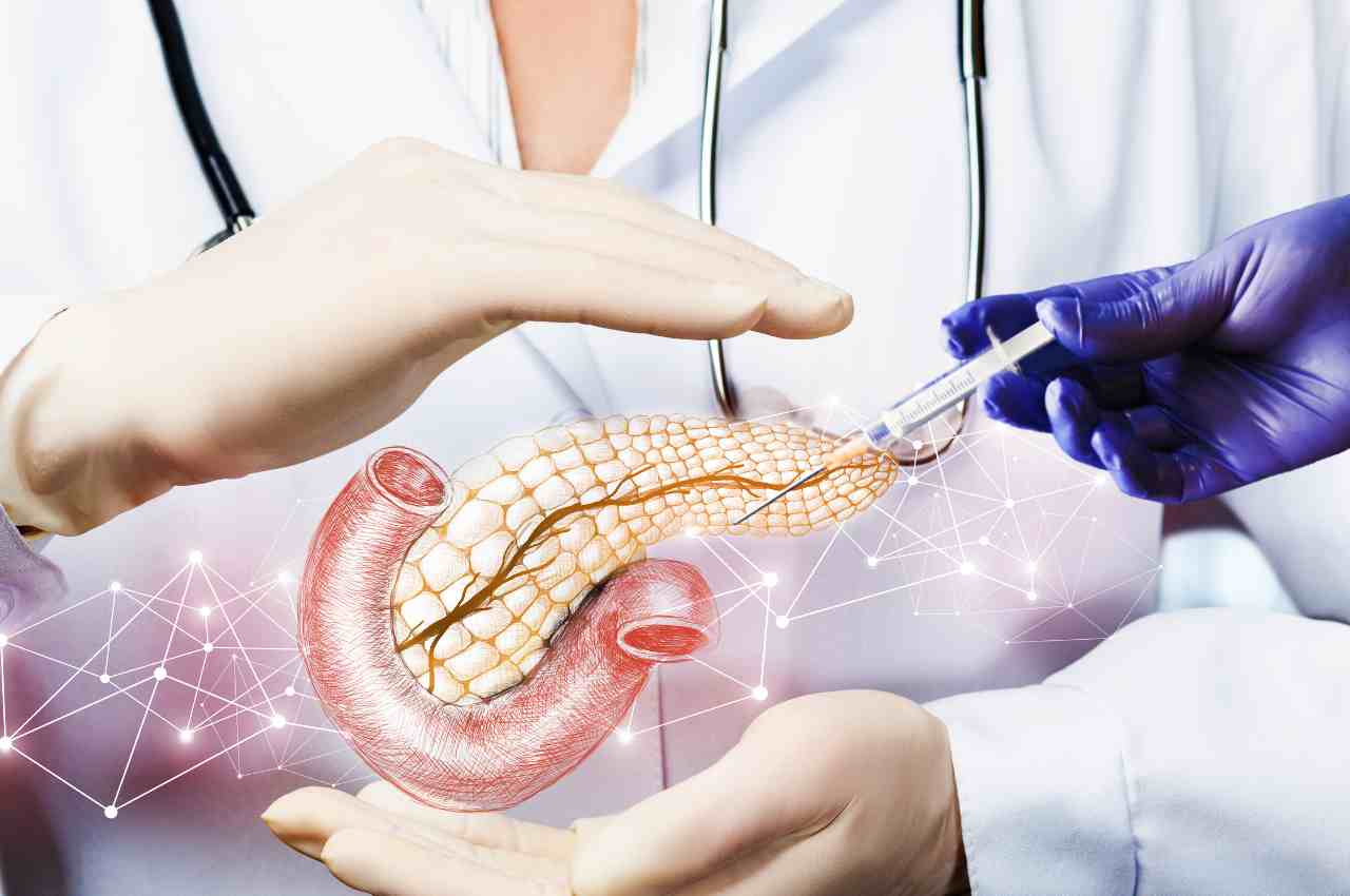 Nuova terapia contro il cancro al pancreas