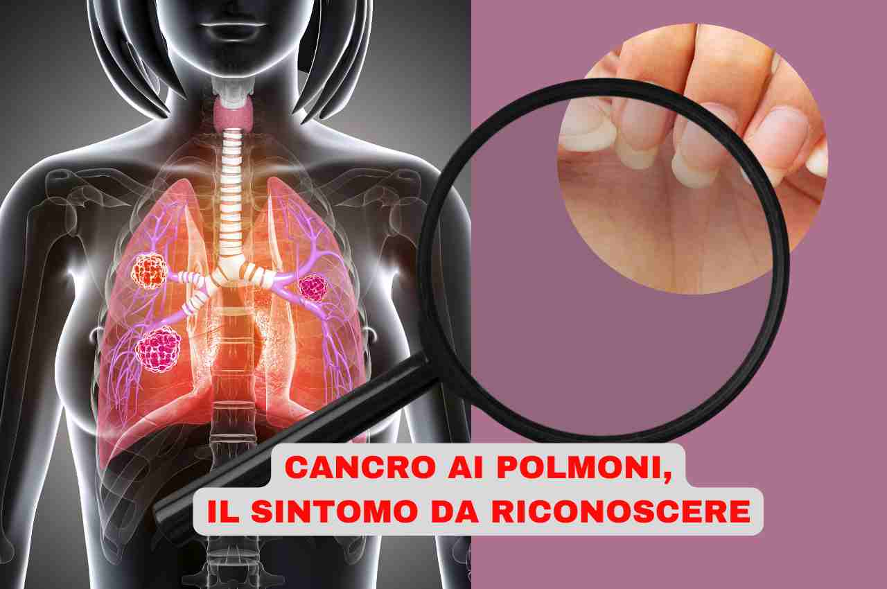 cancro polmoni sintomo