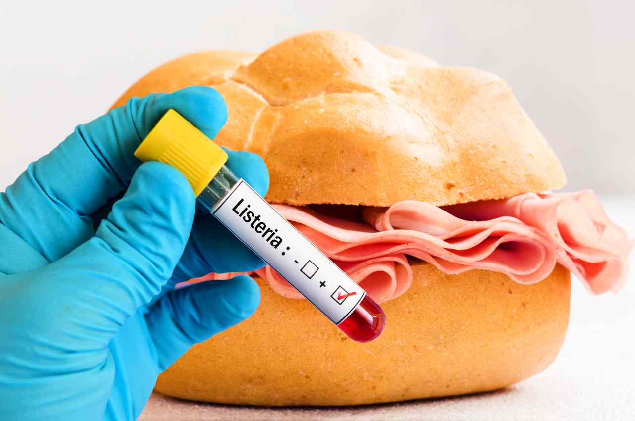 listeria nella mortadella.